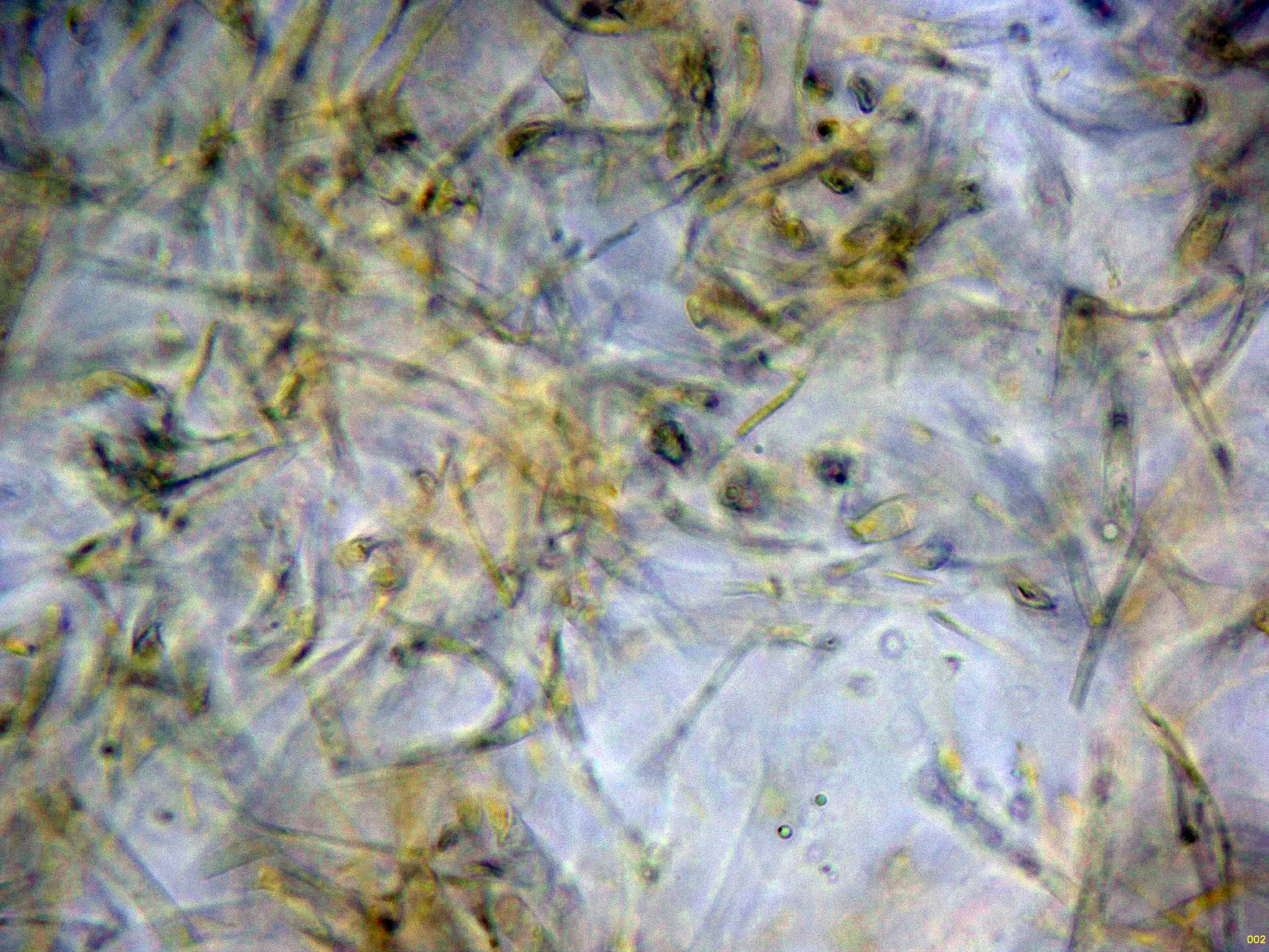 Microscopía de Trichoglossum octopartitum - 16 - Contexto Lugol-002